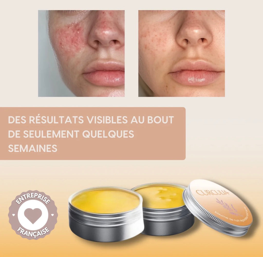 Baumes Curcuma™