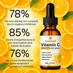 Sérum Éclat Curcuma™